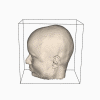 Iso-oppervlak gereconstrueerd uit MRI-scans van het hoofd, de 'baardgroei' komt door ruis in de data.